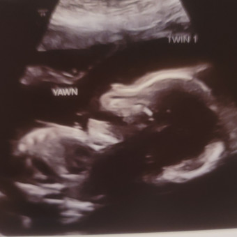 Babylist Registry Photo.