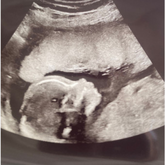 Babylist Registry Photo.