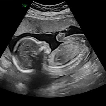 Babylist Registry Photo.