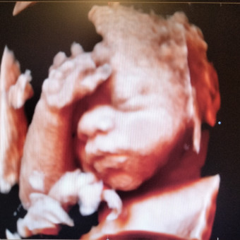Babylist Registry Photo.