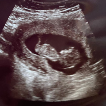 Babylist Registry Photo.