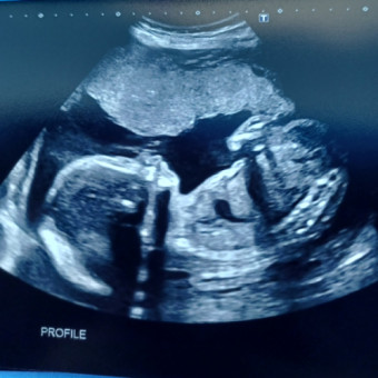 Babylist Registry Photo.