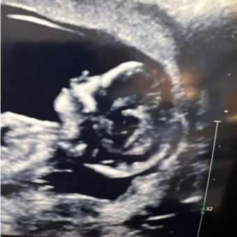 Babylist Registry Photo.