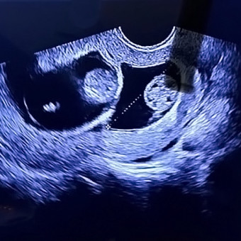 Babylist Registry Photo.