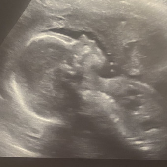 Babylist Registry Photo.