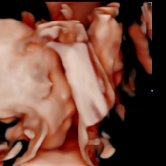 Babylist Registry Photo.