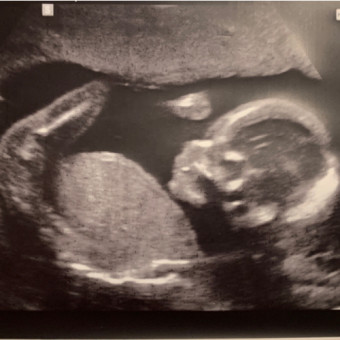 Babylist Registry Photo.