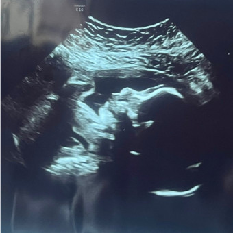 Babylist Registry Photo.