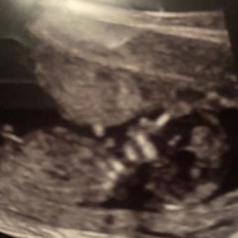 Babylist Registry Photo.