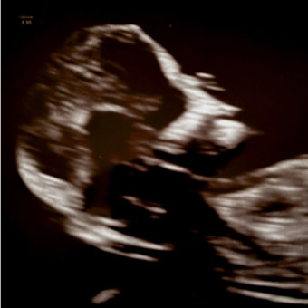 Babylist Registry Photo.