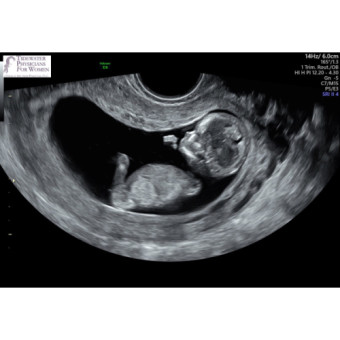 Babylist Registry Photo.
