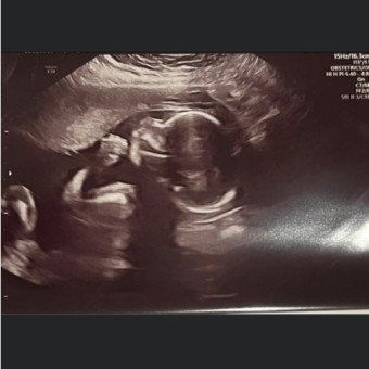 Babylist Registry Photo.