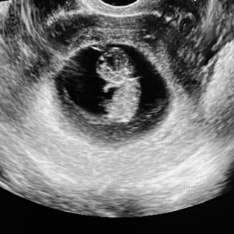 Babylist Registry Photo.