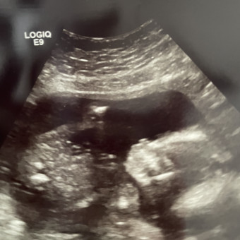 Babylist Registry Photo.