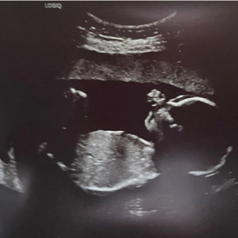 Babylist Registry Photo.