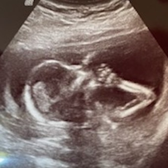 Babylist Registry Photo.