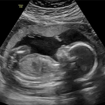 Babylist Registry Photo.