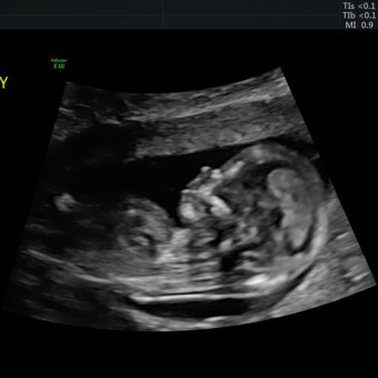 Babylist Registry Photo.