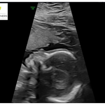Babylist Registry Photo.