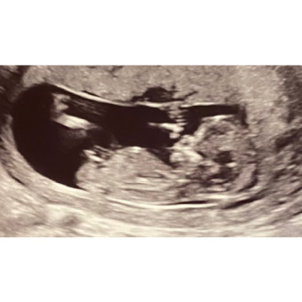 Babylist Registry Photo.