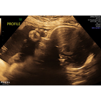Babylist Registry Photo.