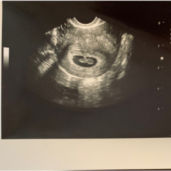 Babylist Registry Photo.
