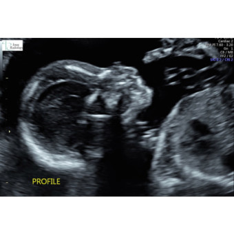 Babylist Registry Photo.