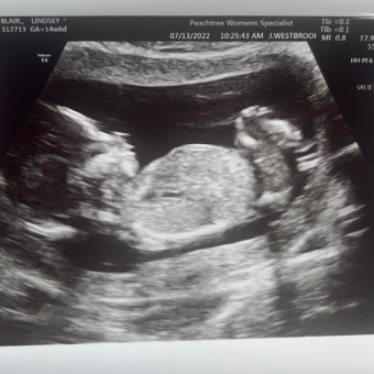 Babylist Registry Photo.