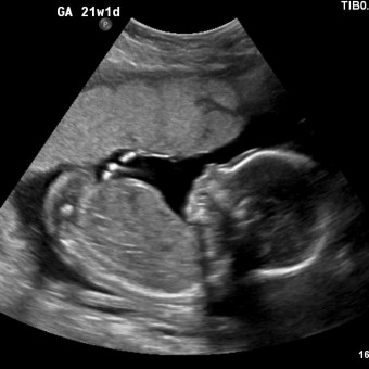 Babylist Registry Photo.