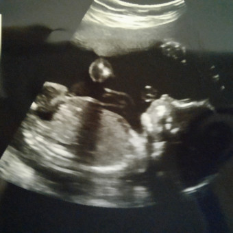 Babylist Registry Photo.