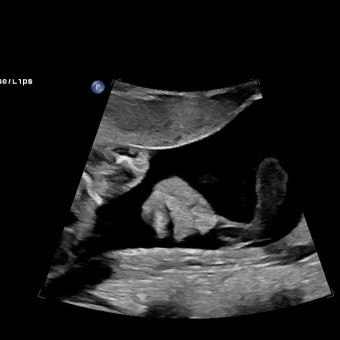Babylist Registry Photo.