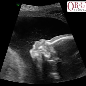 Babylist Registry Photo.