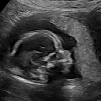 Babylist Registry Photo.