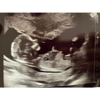 Babylist Registry Photo.