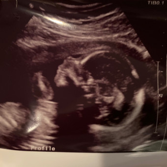 Babylist Registry Photo.