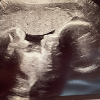 Babylist Registry Photo.