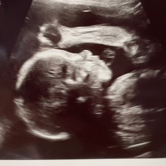 Babylist Registry Photo.