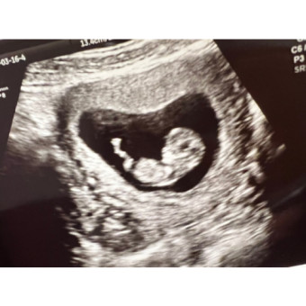 Babylist Registry Photo.