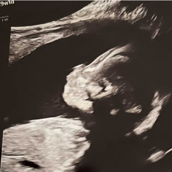 Babylist Registry Photo.