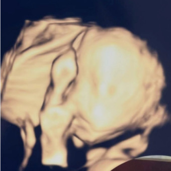Babylist Registry Photo.