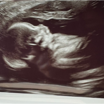 Babylist Registry Photo.