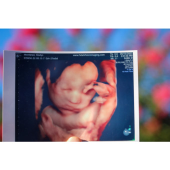 Babylist Registry Photo.