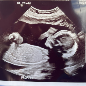Babylist Registry Photo.
