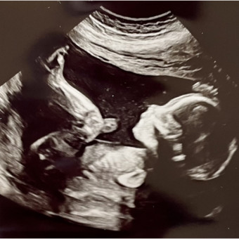 Babylist Registry Photo.