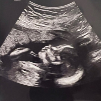 Babylist Registry Photo.