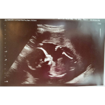 Babylist Registry Photo.