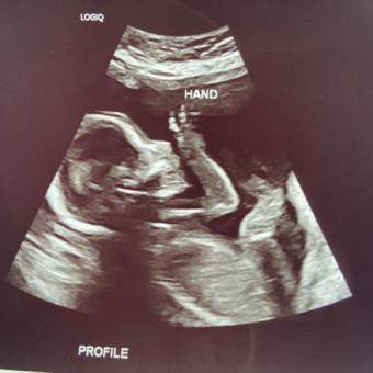 Babylist Registry Photo.