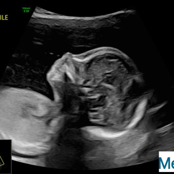 Babylist Registry Photo.