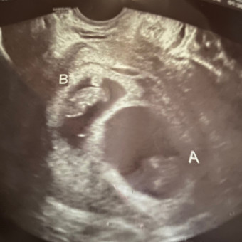 Babylist Registry Photo.