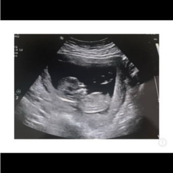 Babylist Registry Photo.